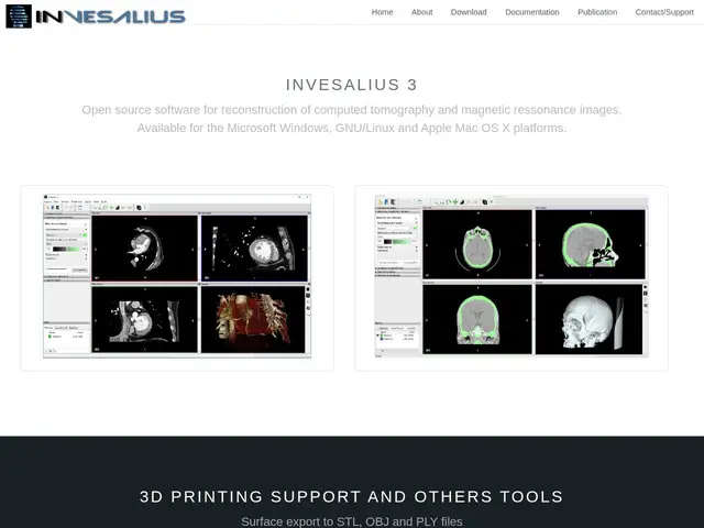 Preview of InVesalius